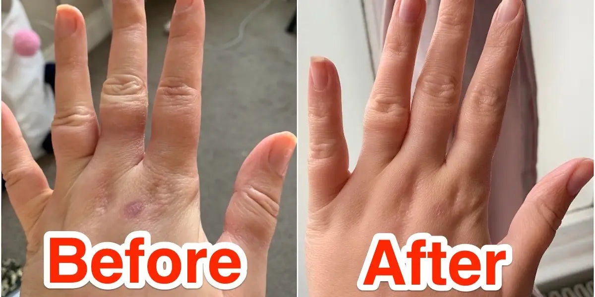 Moisturizer